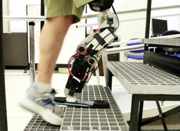 Мыслеуправляемая бионическая нога