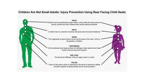 Thumb children are not small adults injury prevention using rear facing child seats