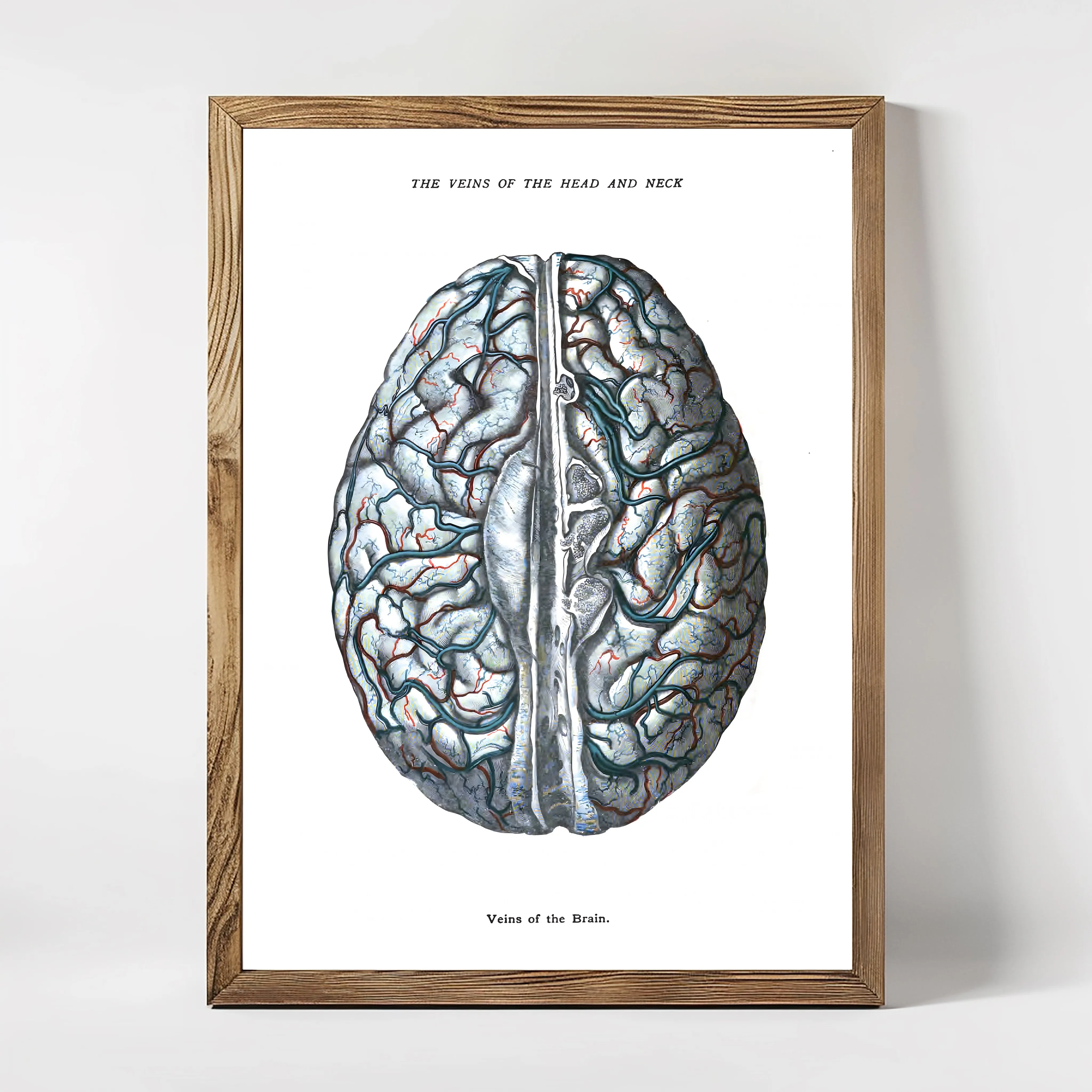 Anatomie Veins of the Brain