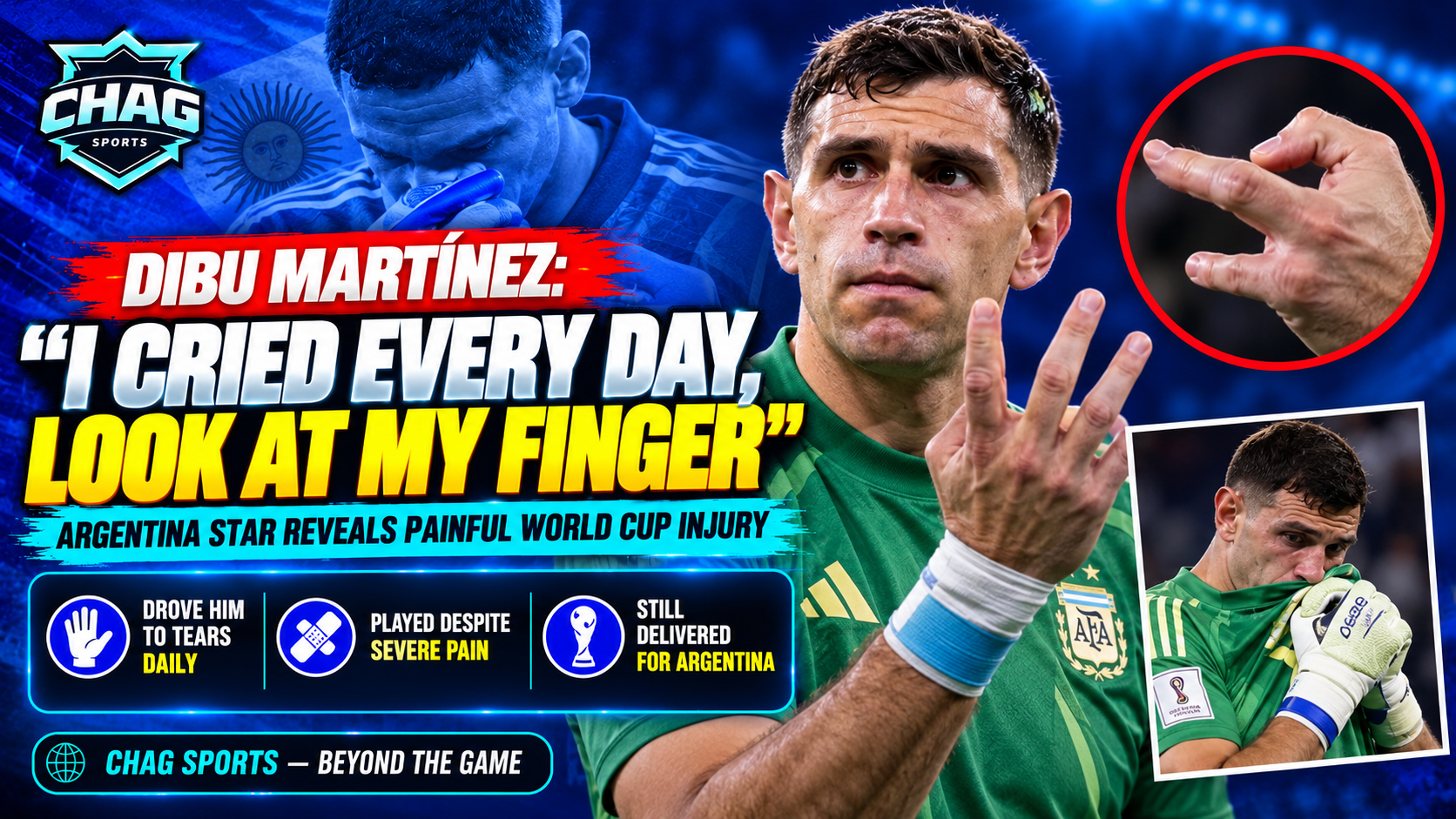 Emiliano Martínez showing his injured finger while explaining the severe pain he endured during Argentina’s 2022 FIFA World Cup campaign.