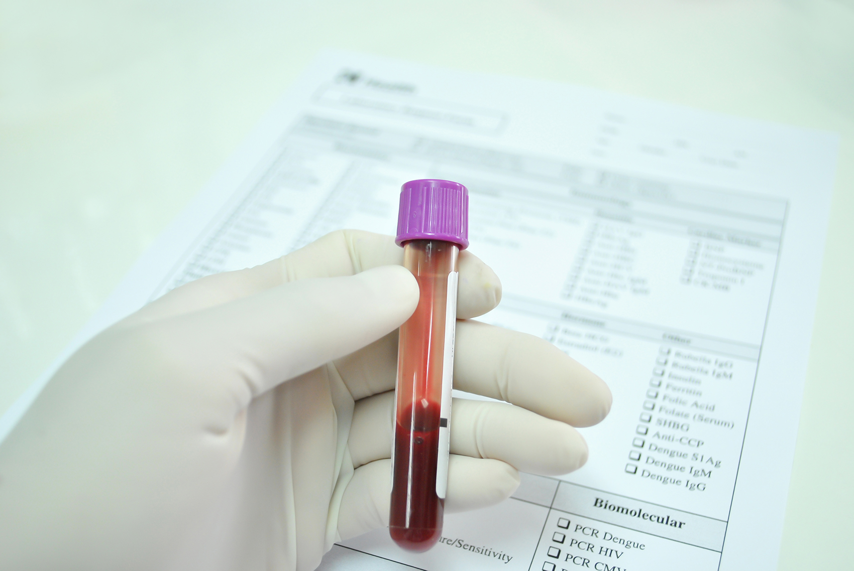 Біохімічний аналіз крові на сироваткове залізо: ключ до виявлення відхилень в організмі