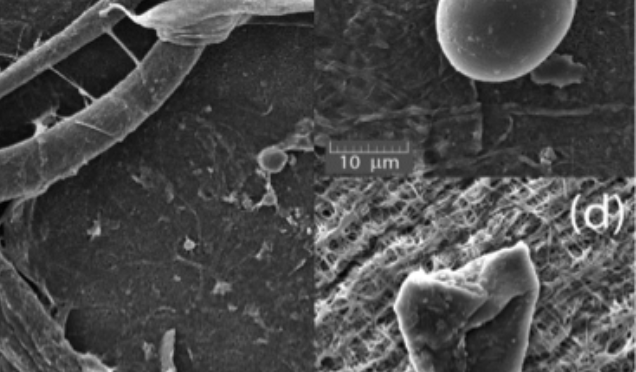 Přítomnost mikroplastů v prostředí nepředstavuje pro člověka akutní hrozbu