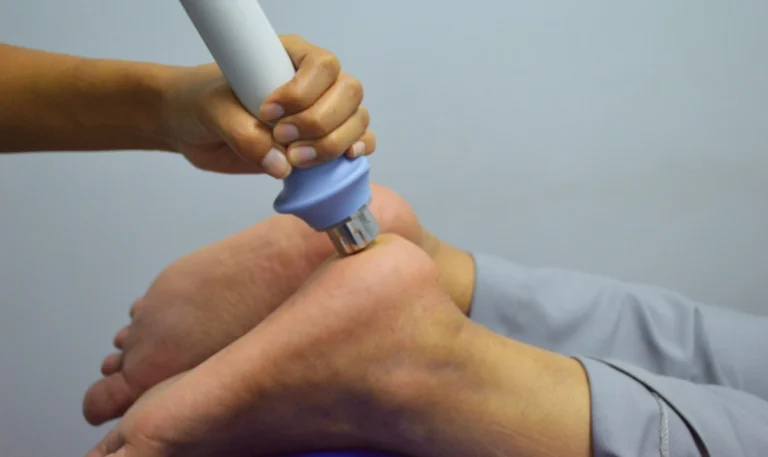 Fascitis plantar, calcificaciones y tendinopatías: cuándo valorar un tratamiento con ondas de choque