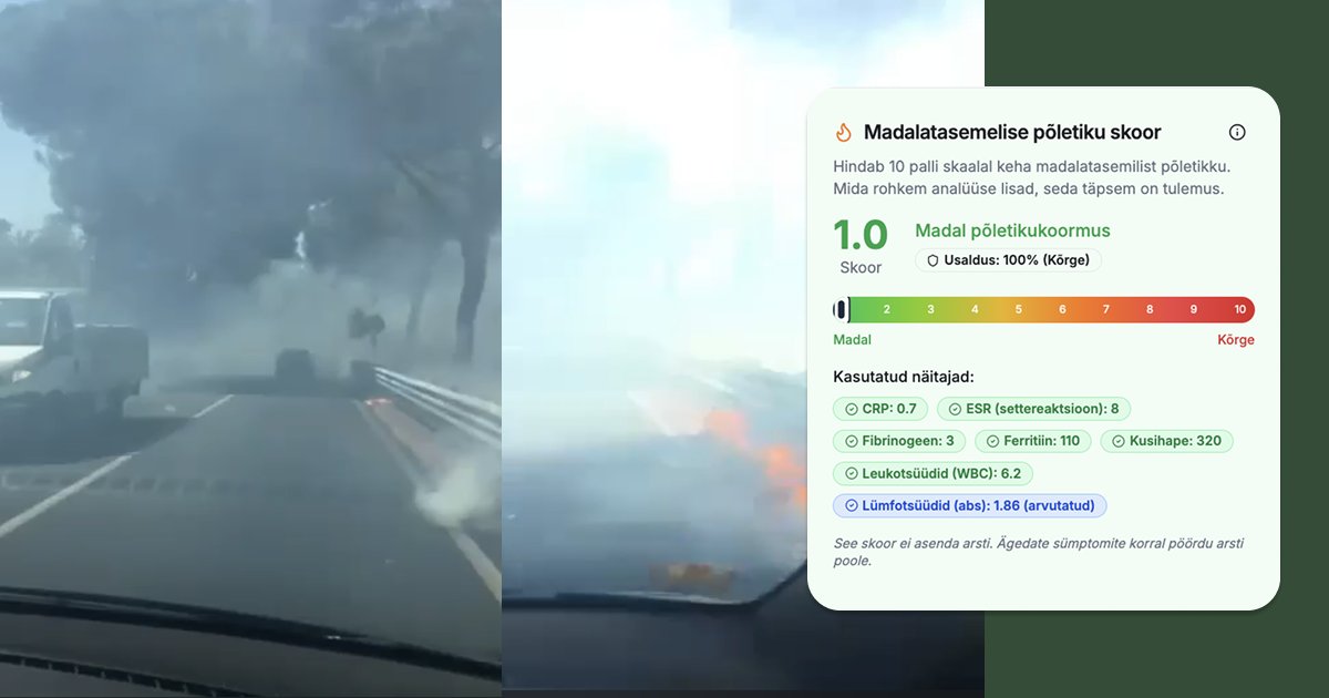Kui ma tahaksin alandada kehas põletikke 30 päevaga, teeksin just seda