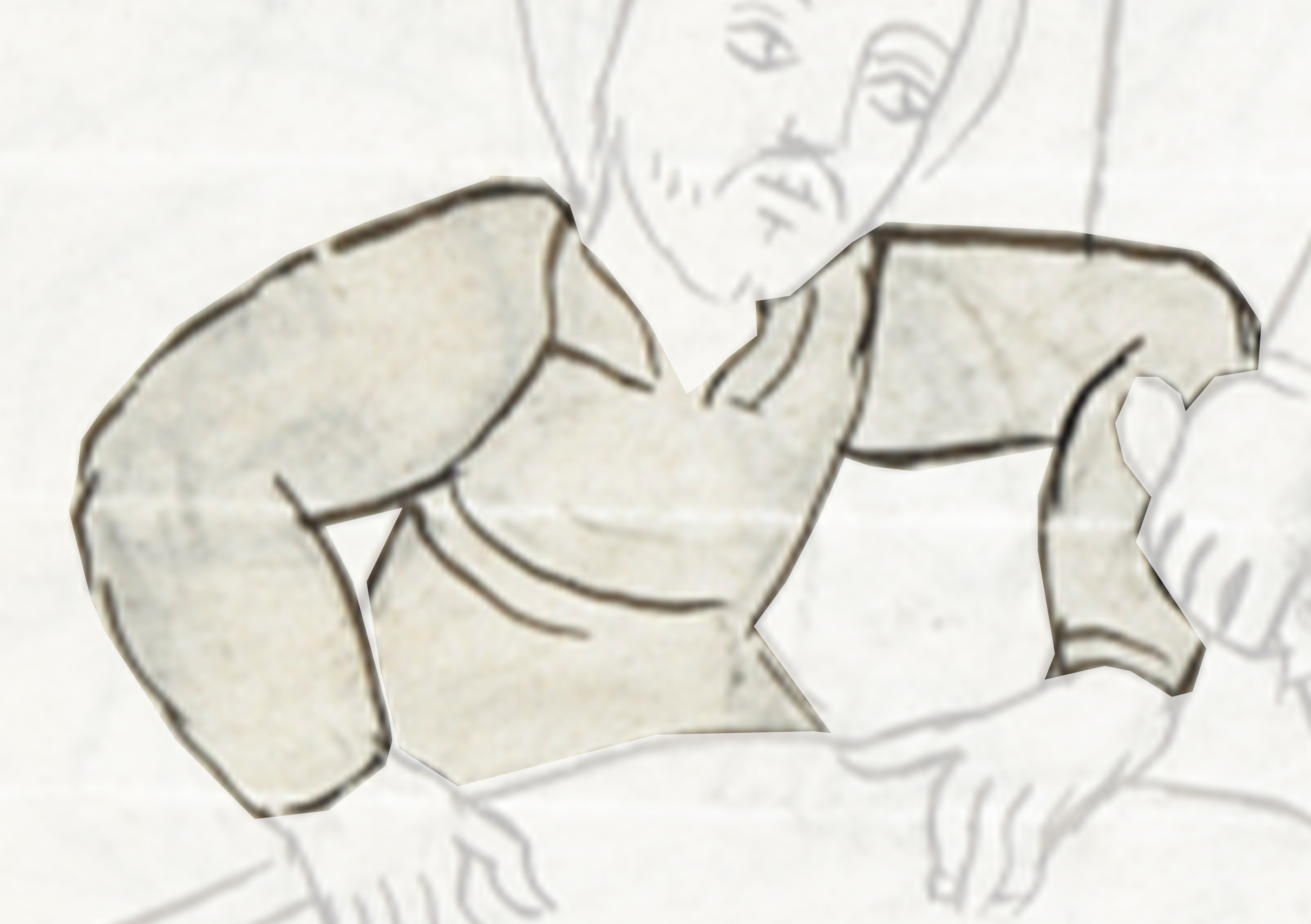 Drawing Of A Man With A Broken Arm