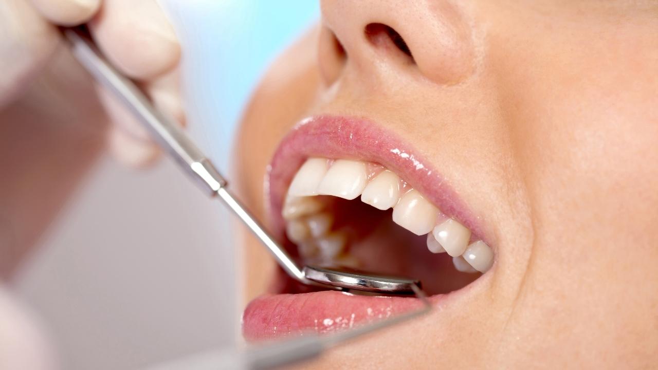 מגוון טיפולי השיניים בהרדמה מלאה