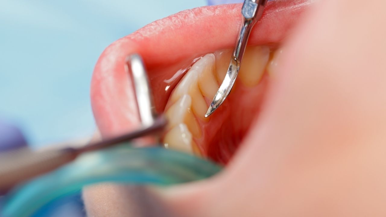 פתרונות מתקדמים ומקצועיים לטיפול וטיפוח השיניים