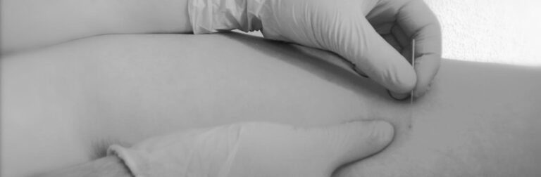 Punción Seca en el Paciente Neurológico – Cofim 2019