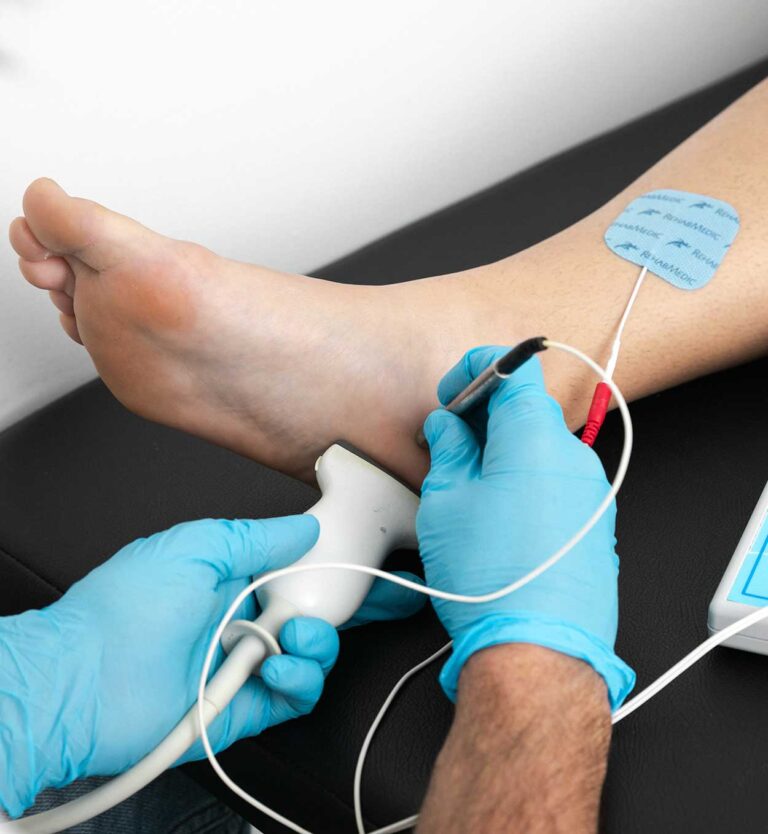 Tratamiento de la Fascitis Plantar con Electrolisis Percutánea Terapéutica – Cofim 2019