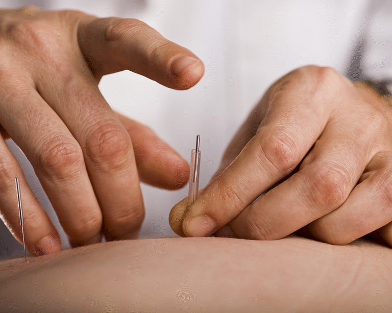 Eficacia de la fisioterapia invasiva en pacientes con dolor crónico resistente