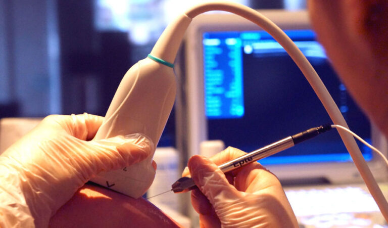 Integración de ecografía y electrolisis percutánea en protocolos clínicos basados en evidencia