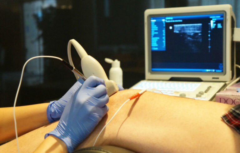 Técnicas invasivas ecoguiadas y su impacto en los resultados funcionales y el rendimiento