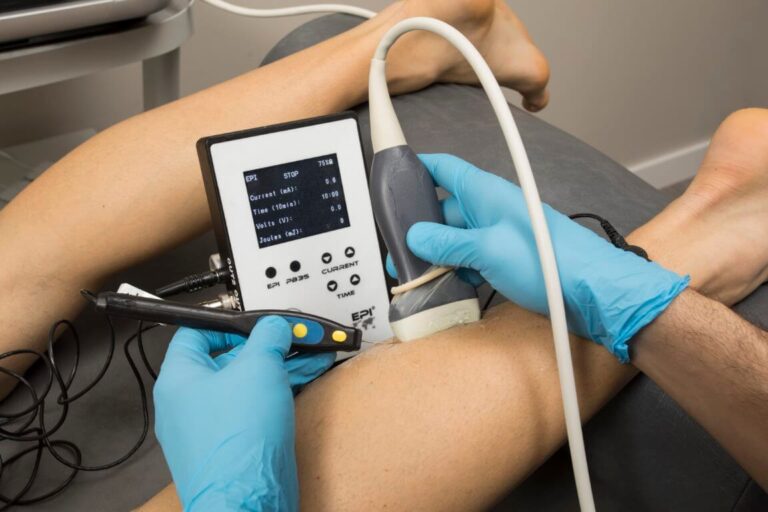 Ecografía musculoesquelética como herramienta docente en fisioterapia invasiva