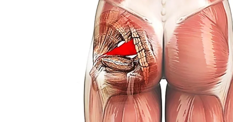 Intervención con técnicas invasivas en el síndrome piramidal: una revisión de la literatura científica reciente