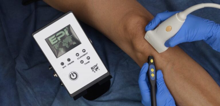 ¿Qué sabemos realmente sobre los efectos tisulares de la electrólisis percutánea?