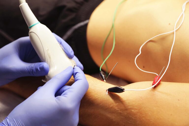 Integrar neuromodulación percutánea con ejercicio terapéutico: modelo de intervención basado en razonamiento clínico
