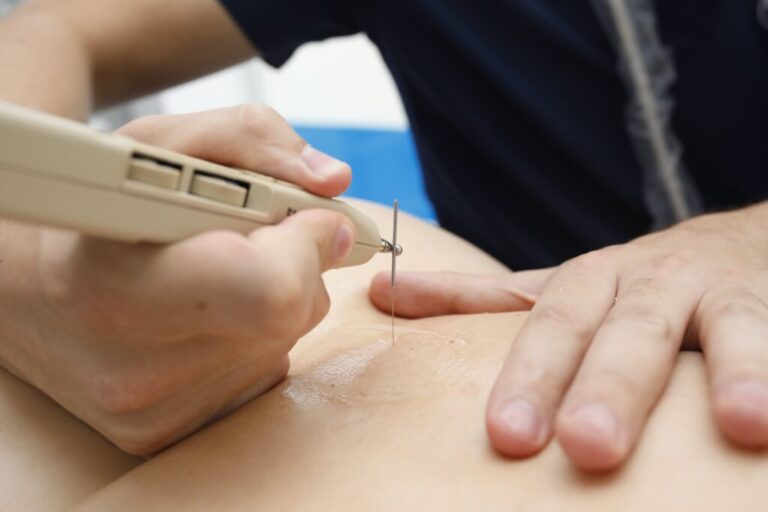 Complicaciones reales en fisioterapia invasiva: incidencia, prevención y manejo clínico