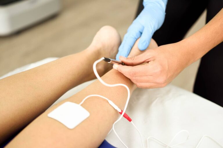 Fisioterapia invasiva en tendinopatía aquílea: integración entre electrólisis, carga y ejercicio terapéutico