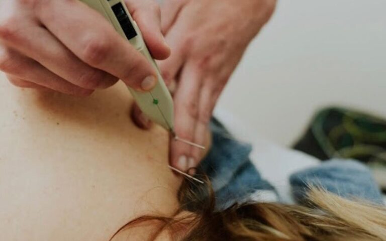 Neuromodulación percutánea en dolor neuropático: evidencia actual y limitaciones clínicas