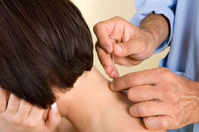 Punción seca en cefalea tensional y cervicogénica: ¿qué resultados son clínicamente relevantes?