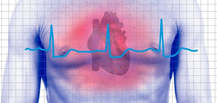 Техасский институт сердечной аритмии проводит международный семинар-практикум по сердечным аритмиям