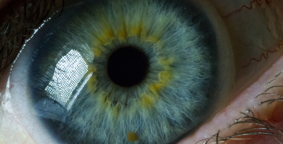 Google запатентовала электронные линзы, которые устанавливаются инъекцией в глаз