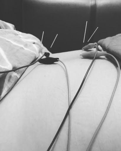Klinik Akupunktur Siligita Husada Nusa Dua