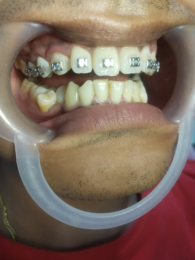 Tukang gigi M RIZKI