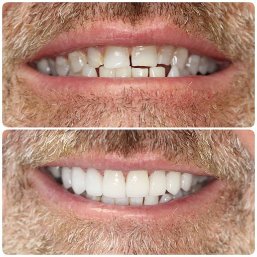 New Smile Dentists / Phuket Dentist