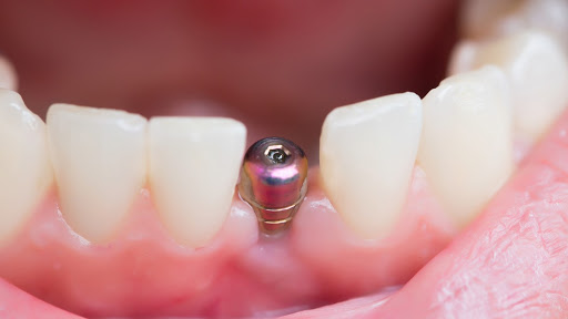 Optimum Care Dental Clinic