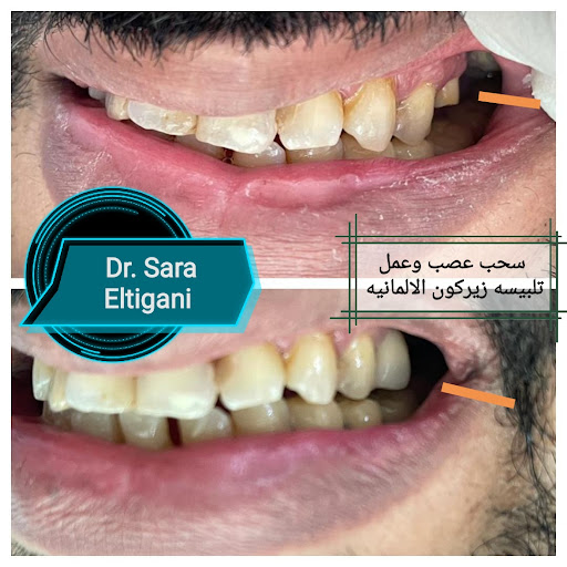 عيادة دكتورة سارة التجاني لطب الاسنان