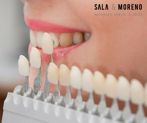 Clínica Dental Valencia Sala & Moreno | Implantes Dentales
