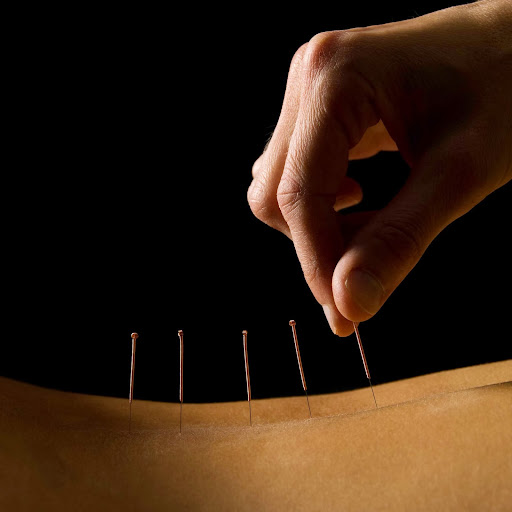 Doctor Li Wong Acupuncture