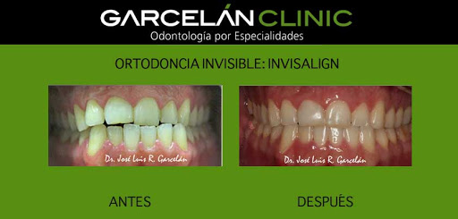 Clínica Dental Garcelán - Dentista Sevilla