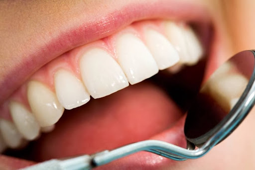 Smile Creations Dental - Dr. Steven Lee, DDS, Dr. Zhou Teri Li, DDS.