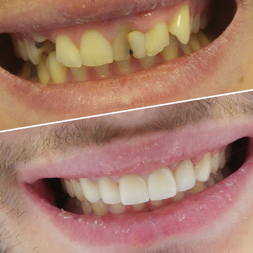 DentisLife Ağız ve Diş Sağlığı Polikliniği