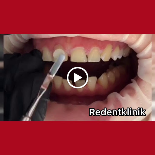 Redent Ağız ve Diş Sağlığı Polikliniği