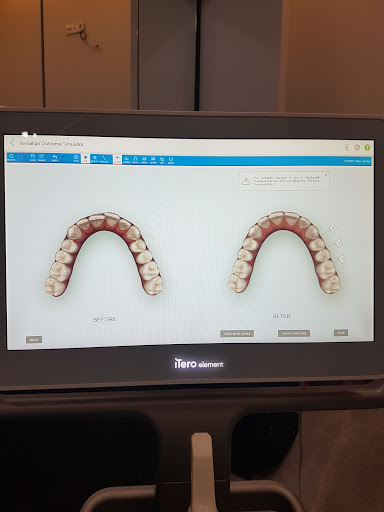 Dr. Derviş Emre ERCAN Ortodonti Kliniği - Invisalign Ankara Şeffaf Plak ve Diş Teli Tedavisi - Ortodonti Ankara