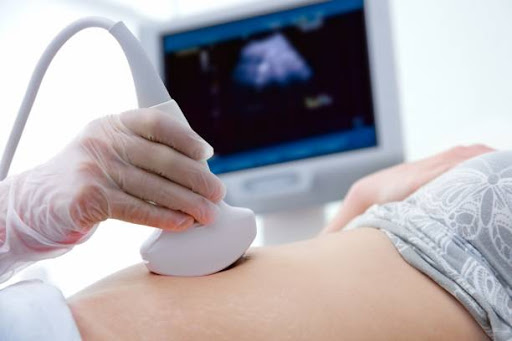 Sneak a Peek Baby 4D Ultrasound