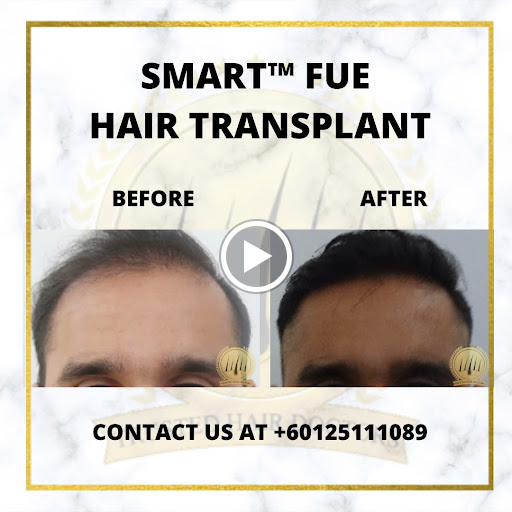 Hair Transplant Specialist Medical Centre Malaysia | Masters of Hair Transplant International Award Winner 2021 - Dato’ & Dr Md Ali (Plastic Surgeon) | Pioneer Fellowship (FISHRS) & ABHRS Diplomate in Malaysia