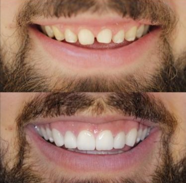 Clínica Dental Dadent - Implantes, Ortodoncia invisible Invisalign y Prótesis dentales en Granada