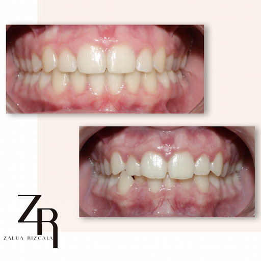 Clínica Dental DentalPlus-Maracena-Dres.Rizcala Especialistas en Ortodoncia (Convencional e Invisible) y Cirugía Oral