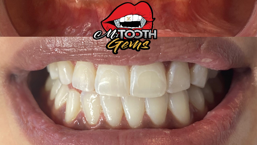 M’s Tooth Gems
