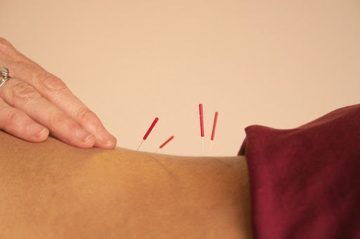 Berkeley Massage & Acupuncture