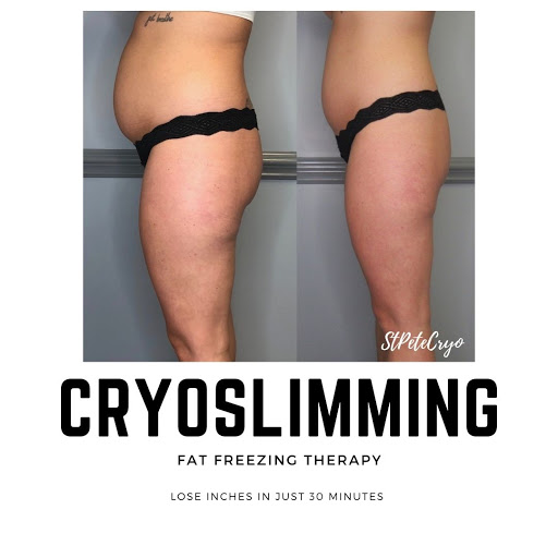Cryoskin of St Petersburg (Cryo Slimming/Toning/Facial) and Light Therapy