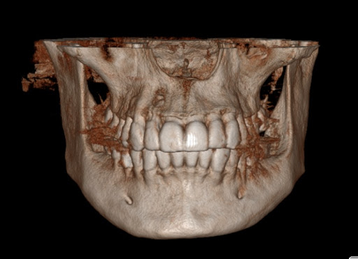 Doc Dental radiologia Odontológica