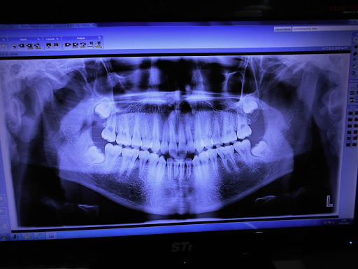 X Digital Radiologia Odontológica