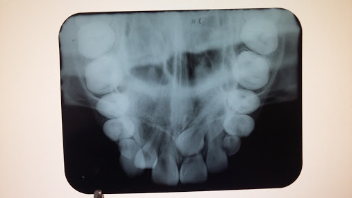 "Oriente", Radiología Dental