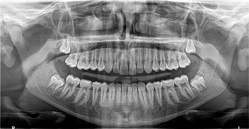 Radiología Digital Dental Azcapotzalco