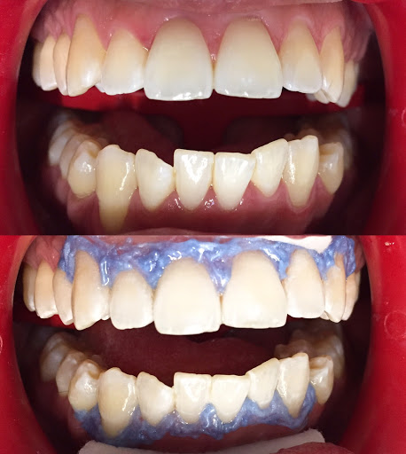 Dentsthetic by CD. Jurado
